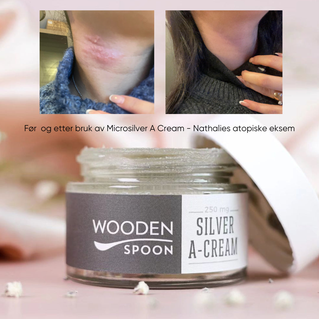 Wooden Spoon | Krem for Atopisk og Tørr Hud, 100% Naturlig, "Silver A-Cream" | 50 ml